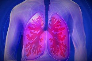 🧡  Asbestosis Síntomas Pulmonares de Asbestosis Pulmonar