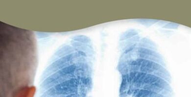 asbestosis y cáncer de pulmón